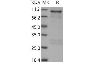 RPS6KA2 Protein (GST tag)