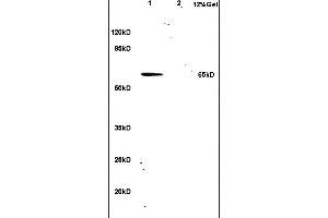 L1 rat lung lysates L2 human colon carcinoma lysates probed with Anti hnRNP L Polyclonal Antibody, Unconjugated (ABIN706631) at 1:200 in 4 °C. (HNRNPL 抗体  (AA 501-589))