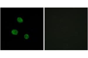 Immunofluorescence analysis of MCF7 cells, using hnRNP M Antibody. (HNRNPM 抗体  (AA 11-60))