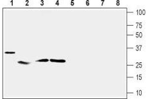 Western blot analysis of mouse heart (lanes 1 and 5), rat skeletal muscle (lanes 2 and 6), rat adipose tissue (lanes 3 and 7) and rat pancreas (lanes 4 and 8): - 1-4. (UCP2 抗体  (Intracellular))