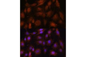 Immunofluorescence analysis of C6 cells using NOB1 antibody (ABIN7270109) at dilution of 1:100. (NOB1 抗体  (AA 1-230))