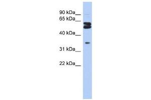 OGFOD1 antibody used at 1 ug/ml to detect target protein. (OGFOD1 抗体  (Middle Region))