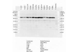 Western Blotting (WB) image for anti-Calreticulin (CALR) antibody (ABIN6656052)