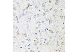 Immunohistochemistry of paraffin-embedded mouse brain using KLK11 antibody (ABIN5975048) at dilution of 1/100 (40x lens). (Kallikrein 11 抗体)