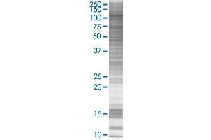 OCRL transfected lysate. (OCRL 293T Cell Transient Overexpression Lysate(Denatured))