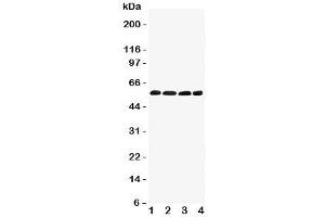 Western blot testing of IRF5 antibody and Lane 1:  human placenta;  2: rat thymus;  3: (r) kidney;  4: (r) ovary tissue lysate. (IRF5 抗体  (C-Term))