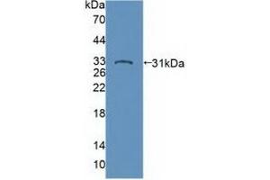 Western blot analysis of recombinant Human PTPN22. (PTPN22 抗体  (AA 1-233))