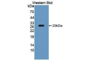 Western Blotting (WB) image for anti-Ubiquitin (Ubiquitin) (AA 1-76) antibody (ABIN1172489) (Ubiquitin 抗体  (AA 1-76))