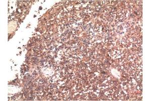 Immunohistochemical analysis of paraffin-embedded Human Brain Tissue using Tau Mouse mAb diluted at 1:200. (tau 抗体)