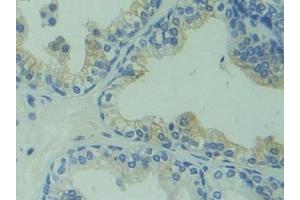 Detection of CAPS in Human Prostate Tissue using Polyclonal Antibody to Calcyphosine (CAPS) (Calcyphosine 抗体  (AA 1-189))