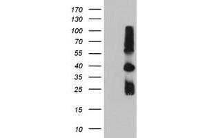 HEK293T cells were transfected with the pCMV6-ENTRY control (Left lane) or pCMV6-ENTRY TIMP2 (Right lane) cDNA for 48 hrs and lysed. (TIMP2 抗体)