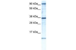 WB Suggested Anti-AKAP7 Antibody Titration:  0. (AKAP7 抗体  (N-Term))