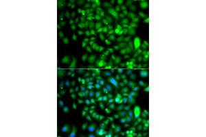 Immunofluorescence analysis of A549 cells using CSRP2BP antibody (ABIN5975516). (CSRP2BP 抗体)