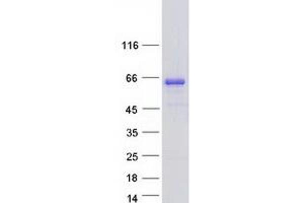 AHCYL2 Protein (Transcript Variant 2) (Myc-DYKDDDDK Tag)