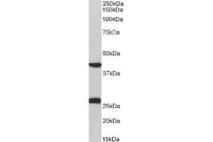 ABIN2562312 (0. (DUSP6 抗体  (C-Term))