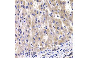 Immunohistochemistry of paraffin-embedded rat liver using RPL14 antibody at dilution of 1:100 (x400 lens). (RPL14 抗体)