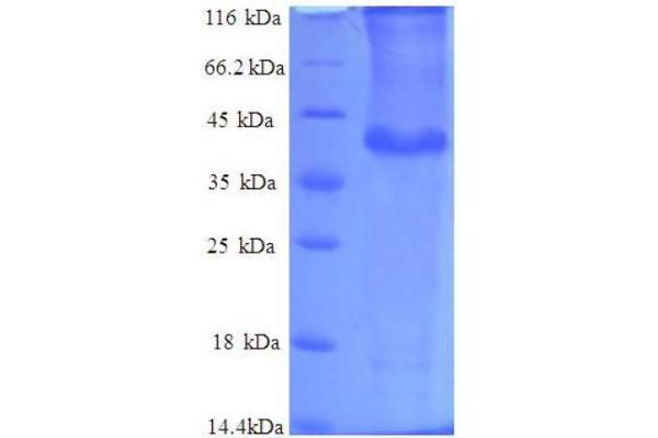 PPP1R11 Protein (AA 1-126, full length) (GST tag)