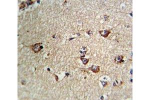 IHC analysis of FFPE human brain tissue stained with CD71 antibody (Transferrin Receptor 抗体  (AA 649-677))