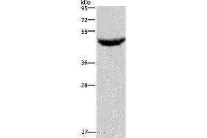Western blot analysis of Human serum solution, using CXCR2 Polyclonal Antibody at dilution of 1:125 (CXCR2 抗体)
