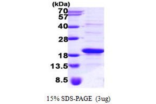 SRP14 Protein (AA 1-136) (His tag)