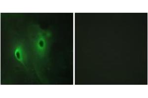 Immunofluorescence analysis of HeLa cells, using DUSP9 Antibody. (DUSP9 抗体  (AA 151-200))