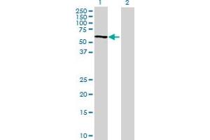 Western Blotting (WB) image for SLC33A1 293T Cell Transient Overexpression Lysate(Denatured) (ABIN1334434)