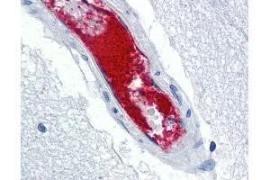 Anti-VWF antibody IHC of human brain, cortex, vessel. (VWF 抗体)