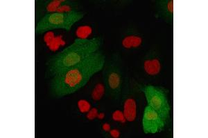 Immunofluorescence (IF) image for anti-S100 Calcium Binding Protein A4 (S100A4) (AA 1-200) antibody (ABIN6940544)