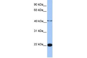 WB Suggested Anti-C2orf68 Antibody Titration: 0. (C2orf68 抗体  (N-Term))