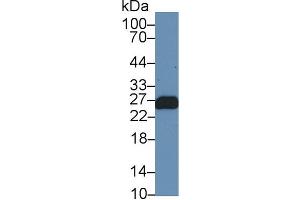 Western Blot; Sample: Mouse Skeletal muscle lysate; Primary Ab: 1µg/ml Rabbit Anti-Human TNNI1 Antibody Second Ab: 0. (TNNI1 抗体  (AA 142-187))