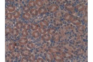 DAB staining on IHC-P; Samples: Mouse Kidney Tissue (Non Metastatic Cells 6, Protein Expressed In (AA 1-184) 抗体)