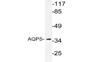 Western blot analysis of AQP5 Antibody in extracts from HUVECcells. (Aquaporin 5 抗体)