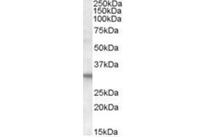 Image no. 1 for anti-Four and A Half LIM Domains 2 (FHL2) (C-Term) antibody (ABIN374413) (FHL2 抗体  (C-Term))