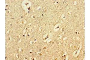 Immunohistochemistry of paraffin-embedded human brain tissue using ABIN7145091 at dilution of 1:100 (ATG5 抗体  (AA 5-272))