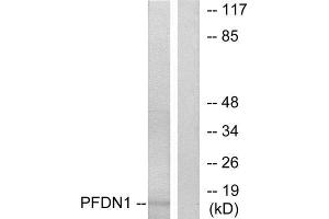 Western Blotting (WB) image for anti-Prefoldin Subunit 1 (PFDN1) (N-Term) antibody (ABIN1849016) (PFDN1 抗体  (N-Term))
