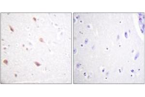 Immunohistochemistry analysis of paraffin-embedded human brain, using NIFK (Phospho-Thr234) Antibody. (NIFK 抗体  (pThr234))