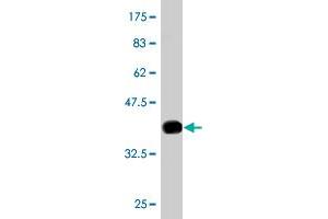 Western Blotting (WB) image for anti-Ubiquitin Protein Ligase E3A (ube3a) (AA 51-150) antibody (ABIN563326)