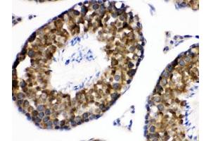 IHC testing of FFPE mouse testis with WNK1 antibody. (WNK1 抗体)