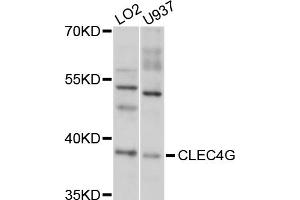 Western blot analysis of extracts of various cell lines, using CLEC4G antibody (ABIN5997464) at 1/1000 dilution. (CLEC4G 抗体)