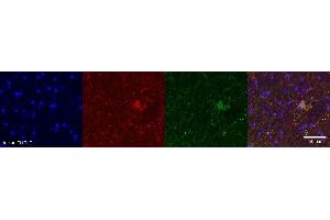 Immunohistochemistry (IHC) image for anti-Aquaporin 4 (AQP4) antibody (ABIN7456316)