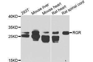 Western blot analysis of extracts of various cell lines, using RGR antibody. (RGR 抗体)