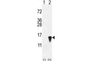 Western Blotting (WB) image for anti-ISG15 Ubiquitin-Like Modifier (ISG15) antibody (ABIN2996231) (ISG15 抗体)