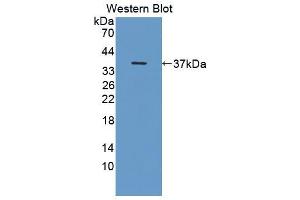 Western blot analysis of the recombinant protein. (OTUB1 抗体  (AA 1-271))