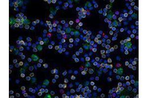 Immunofluorescence (IF) image for anti-CD19 Molecule (CD19) antibody (Alexa Fluor 594) (ABIN2656820) (CD19 抗体  (Alexa Fluor 594))