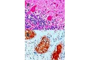 Immunohistochemistry (IHC) image for anti-Dynactin 1 (DCTN1) (C-Term) antibody (ABIN184834)