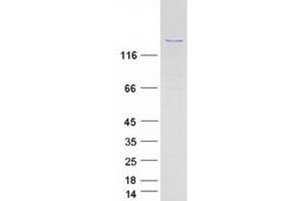 PPP1R13B Protein (Myc-DYKDDDDK Tag)