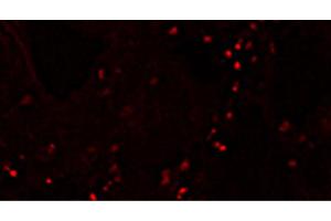 Frozen skin section from piglets immunized with an inactivated chimeric PCV1-2 vaccine post intradermal injection with PCV2 antigen was stained with Mouse Anti-Porcine CD4-PE (CD4 抗体  (PE))