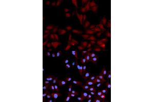 Immunofluorescence analysis of U2OS cells using Phospho-MAPK14-Y182 antibody (ABIN5969911). (MAPK14 抗体  (pTyr182))