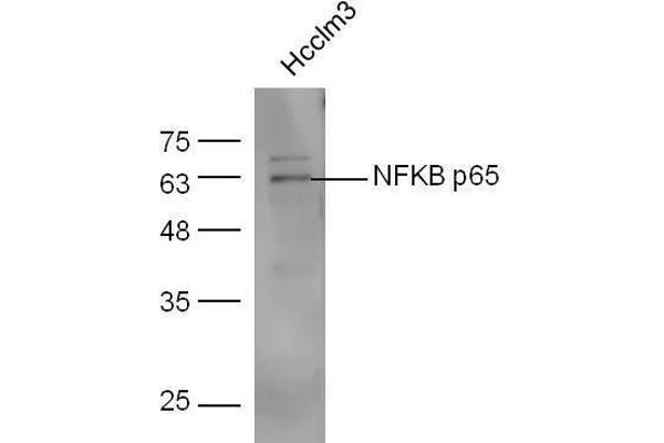NF-kB p65 抗体  (AA 51-100)