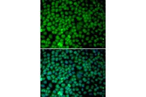 Immunofluorescence analysis of MCF-7 cells using RBX1 antibody (ABIN5970933). (RBX1 抗体)